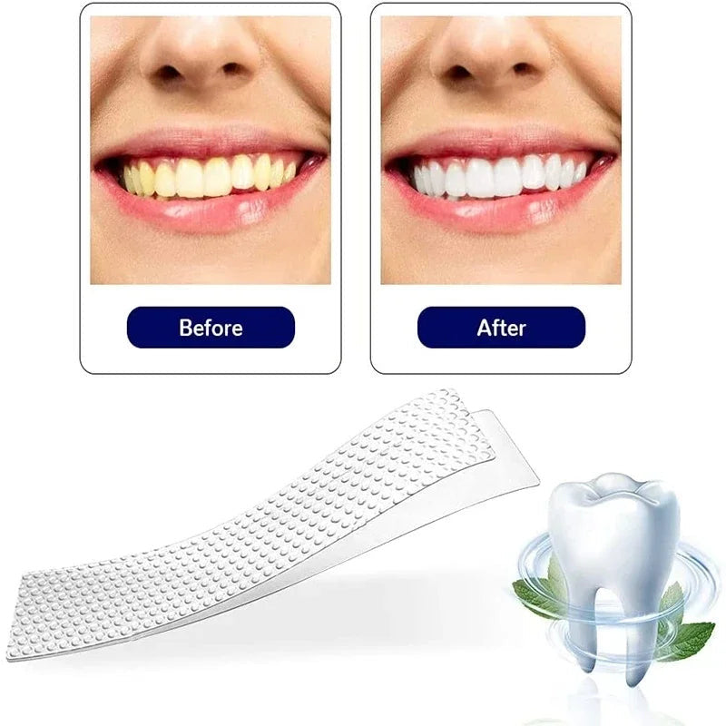 5D Teeth Whitening Strip 14